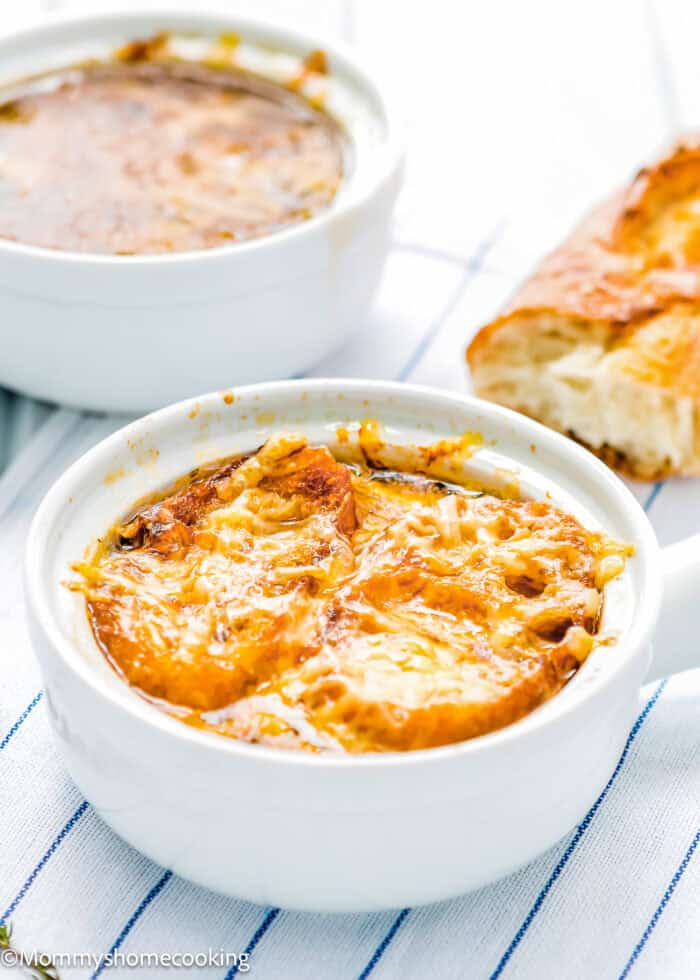Two bowls of easy classic onion soup topped with melted cheese sit on a striped cloth, accompanied by a piece of bread.